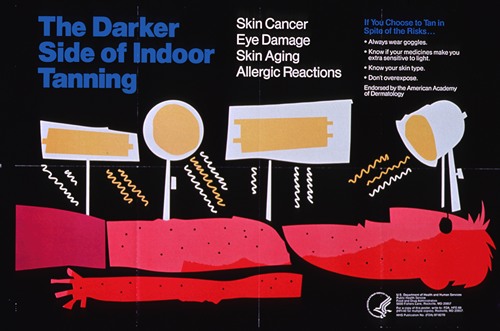 The darker side of indoor tanning, skin cancer, eye damage, skin aging, allergic reactions (1987)