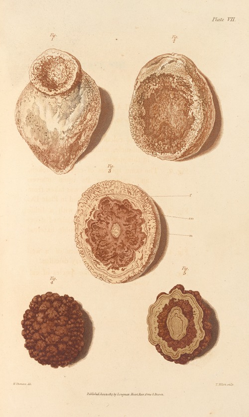 An Essay on the Chemical History and Medical Treatment of Calculous Disorders Pl.4