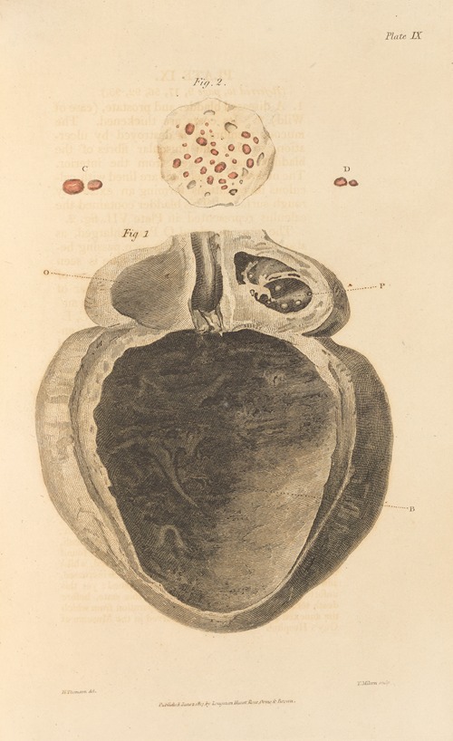 An Essay on the Chemical History and Medical Treatment of Calculous Disorders Pl.6