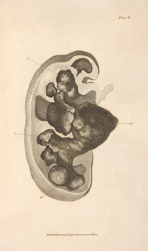 An Essay on the Chemical History and Medical Treatment of Calculous Disorders Pl.8