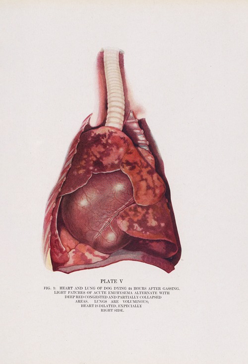 Plate V (Fig. 1): Heart and lung of dog dying 24 hours after gassing.