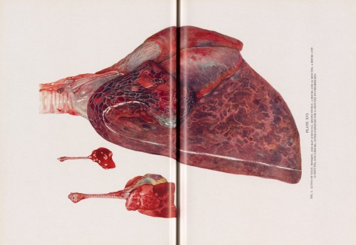 Plate XVI (Fig. 1): Lungs of goat, monkey, and rat surviving, respectively, 4 hours and 10 minutes, 4 hours and 55 minutes, and 6 hours, after exposure for 15 minutes to chlorpicrin.