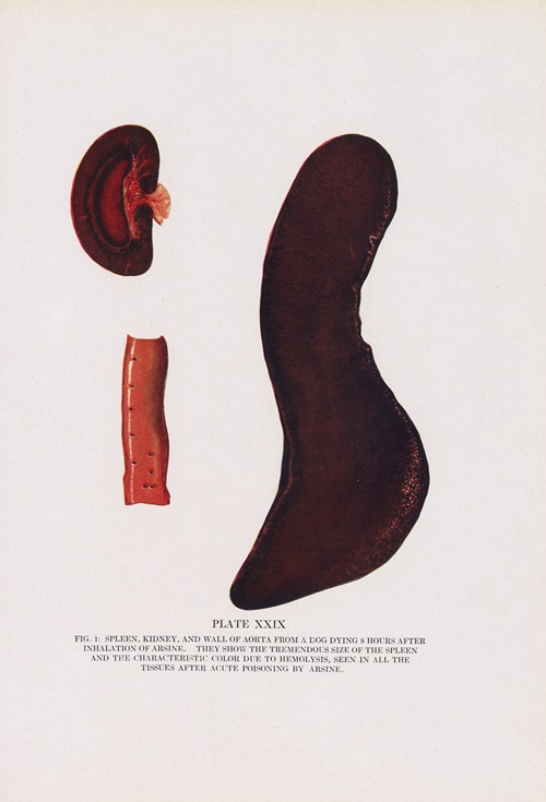 Plate XXIX (Fig. 1): Spleen, kidney, and wall of aorta from a dog dying 8 hours after inhalation of arsine.