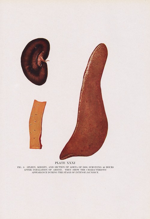 Plate XXXI (Fig. 3): Spleen, kidney, and section of aorta of dog surviving 49 hours after inhalation of arsine.