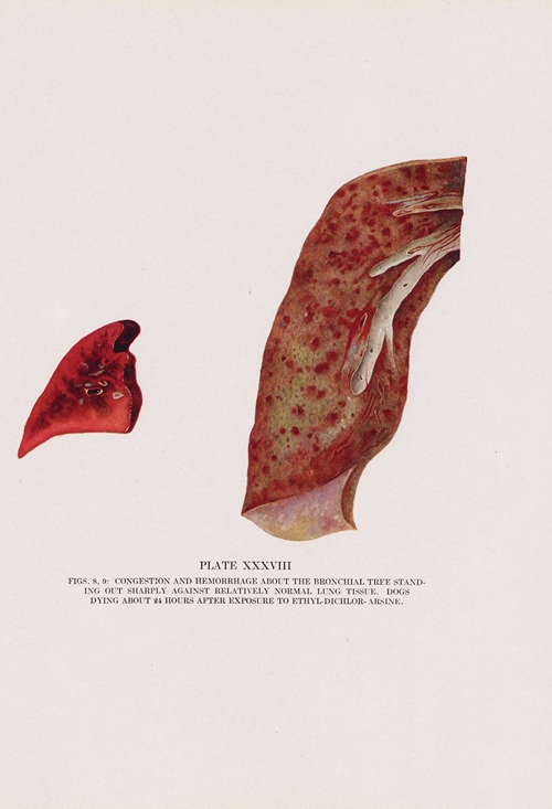 Plate XXXVIII (Figs. 8, 9): Congestion and hemorrhage about the bronchial tree standing out sharply against relatively normal lung tissue.