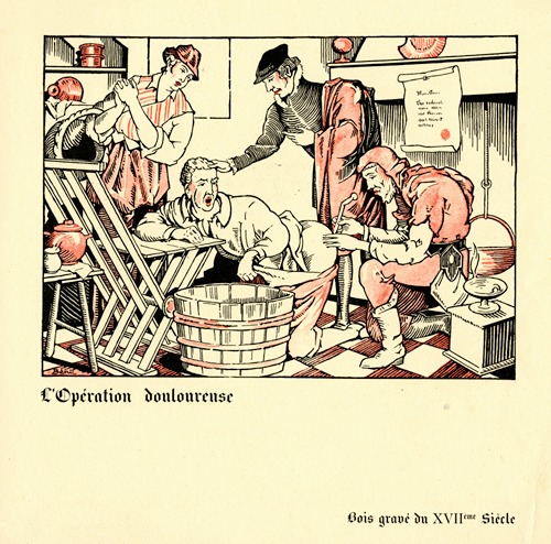 L’opération douloureuse