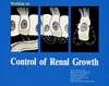 Workshop on control of renal growth