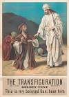 The transfiguration