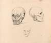 Three Studies of the Skull of Jacobean Antonio Timmerman from Dunkirk
