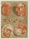 Four Dissected Heads with Details of Eyes