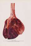 Plate XXVII (Fig. 1): Lungs of dog, surviving 5 hours, gassed with a high concentration of cyanogen chloride.