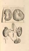 Anatomia humani corporis Pl.044