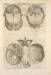 Quarta pagina figurarum capitalium [12 illustrations of the brain]