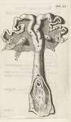 Anatomical illustration of the cervix, uterus, fallopian tubes and ovaries