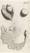 Anatomical illustration of the fallopian tube and ovaries