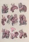 Surgical anatomy Pl.15