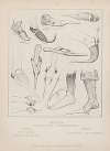 Europe; XVth century; Coverings for the feet