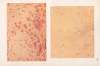 Venereal diseases – Syphilis Pl.07