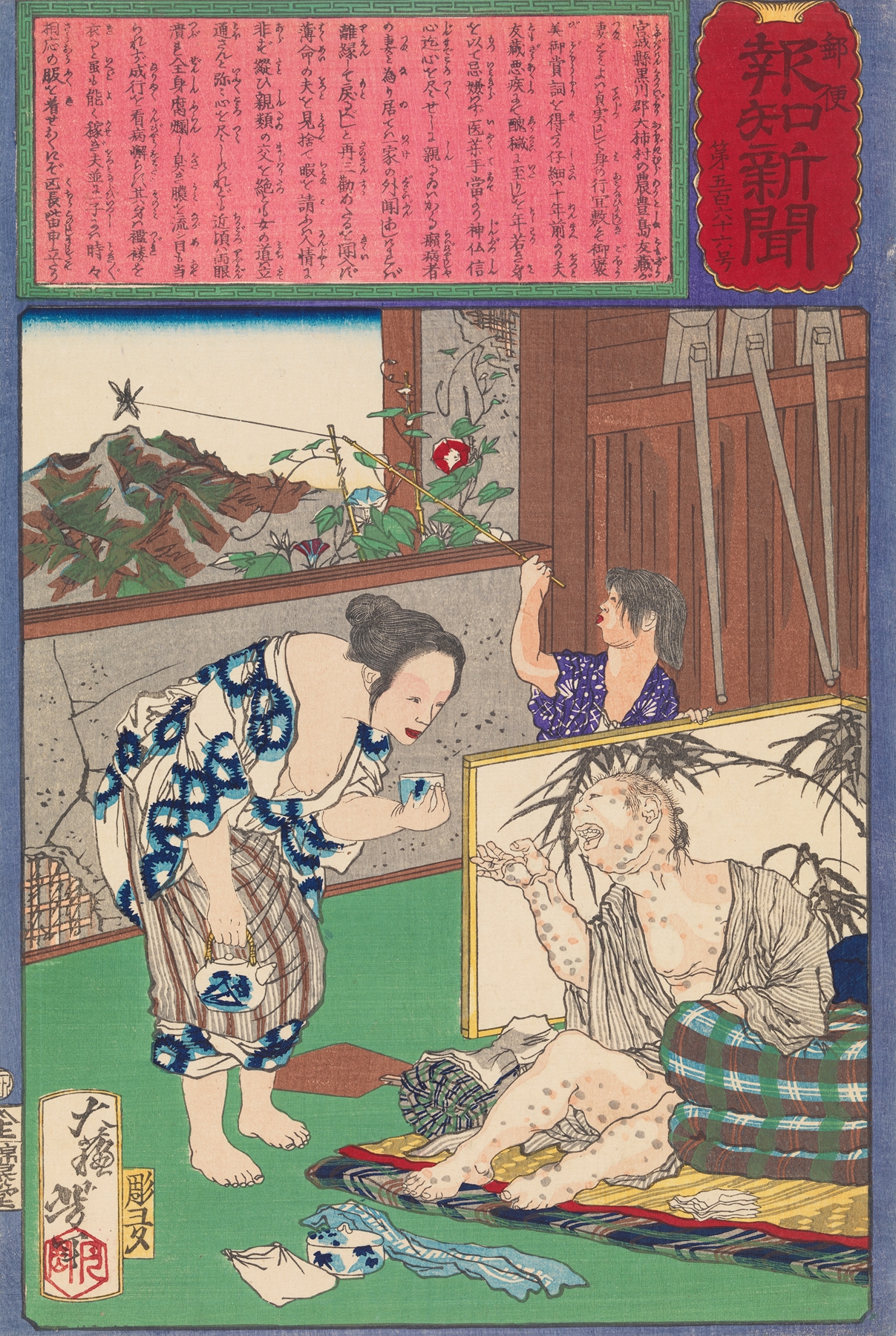 Toshima Tomiyo Who Stayed with Her Leper Husband, Tomozō (1875)