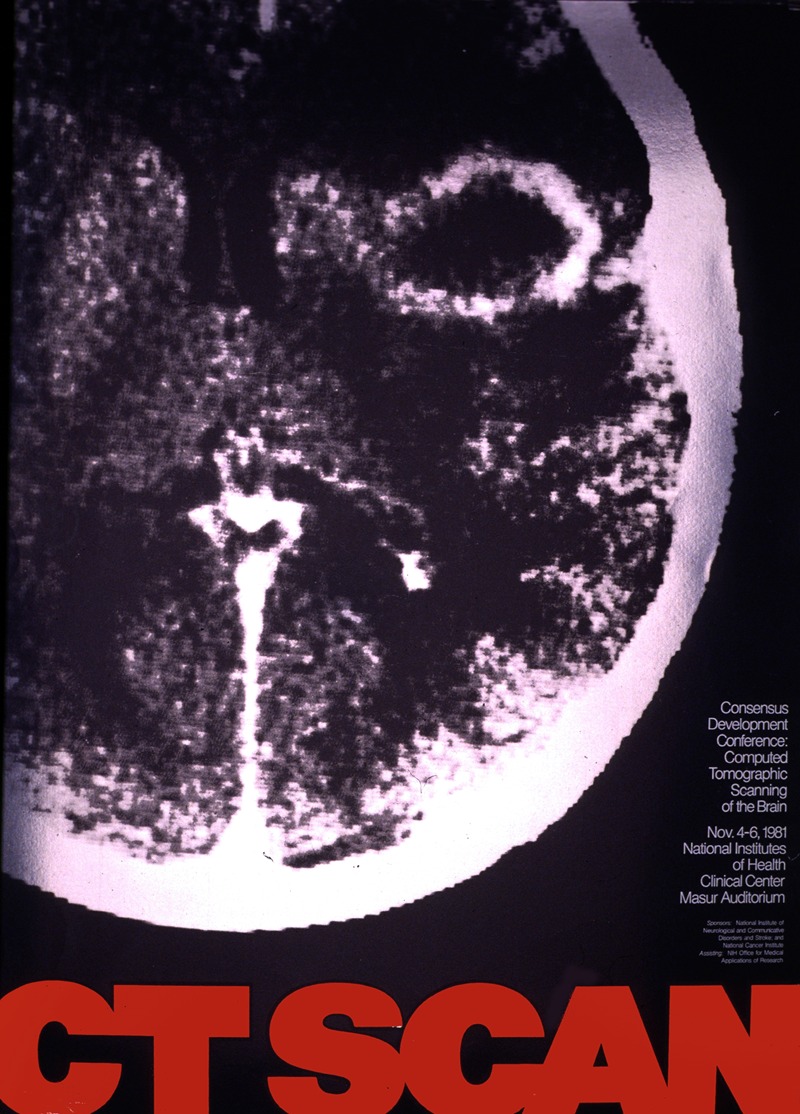 National Institutes of Health - CT scan