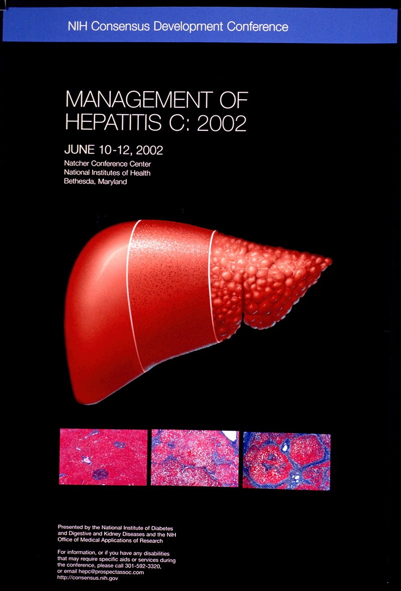 National Institutes of Health - Management of hepatitis C