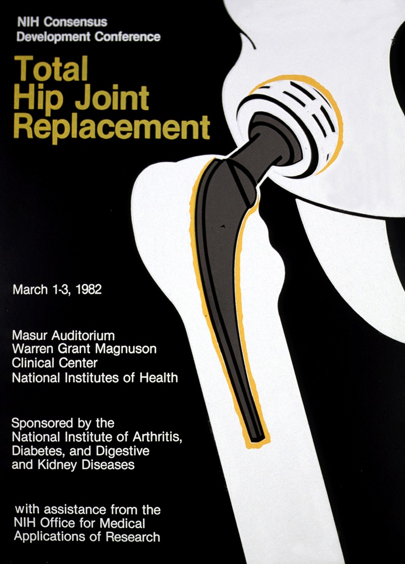 National Institutes of Health - Total hip joint replacement