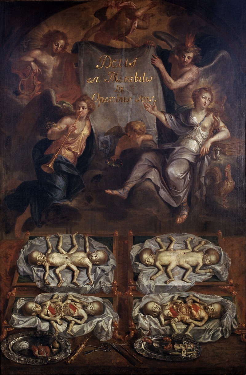 Norbert Sauvage - Dissection of Siamese Twins