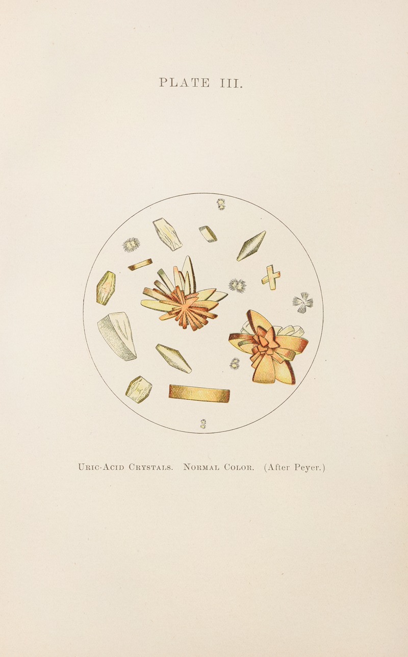 Charles Wesley Purdy - Plate III: Uric-Acid Crystals (Normal Color)