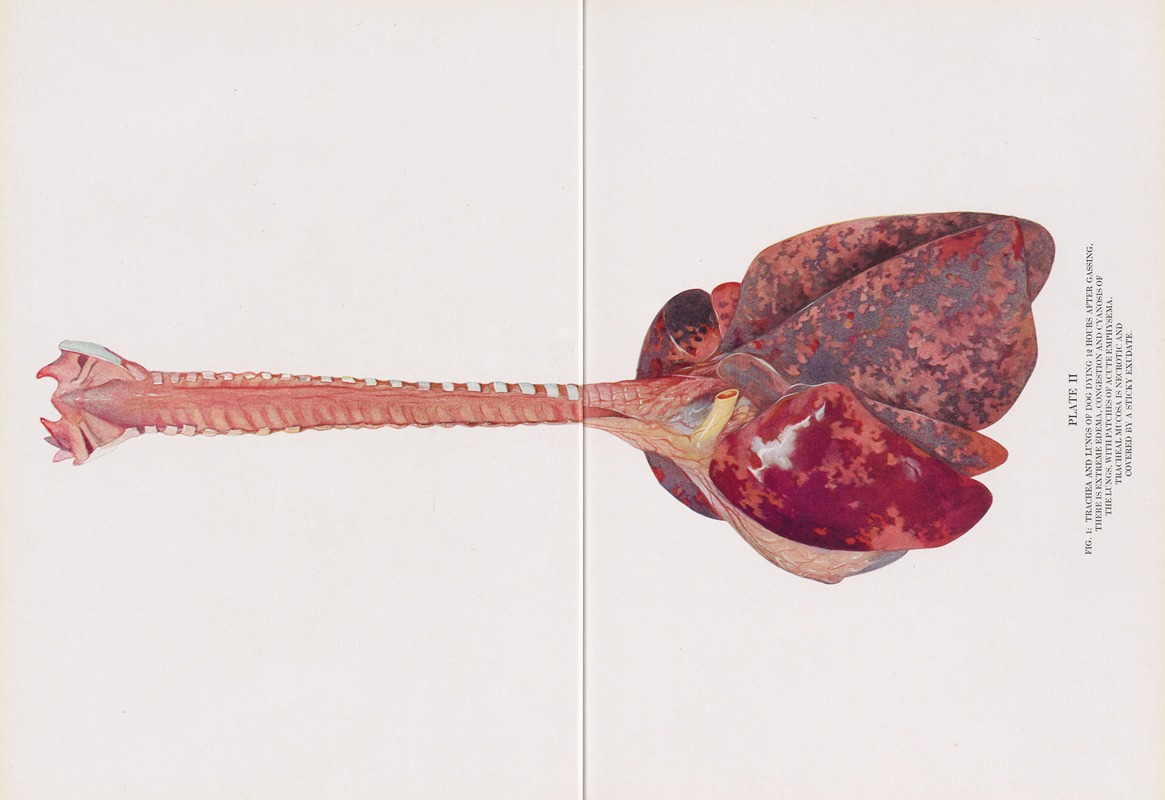 Milton C. Winternitz - Plate II (Fig. 1): Trachea and lungs of dog dying 12 hours after gassing.