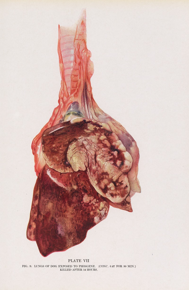 Milton C. Winternitz - Plate VII (Fig. 3): Lungs of dog exposed to phosgene.