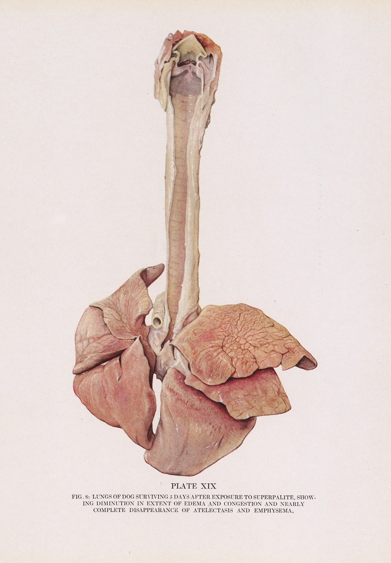 Milton C. Winternitz - Plate XIX (Fig. 8): Lungs of dog surviving 5 days after exposure to superpalite, showing diminution in extent of edema and congestion and nearly complete disappearance of atelectasis and emphysema.
