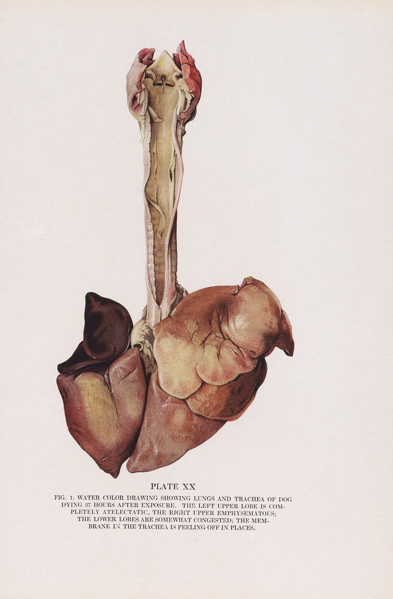 Milton C. Winternitz - Plate XX (Fig. 1): Water color drawing showing lungs and trachea of dog dying 37 hours after exposure.