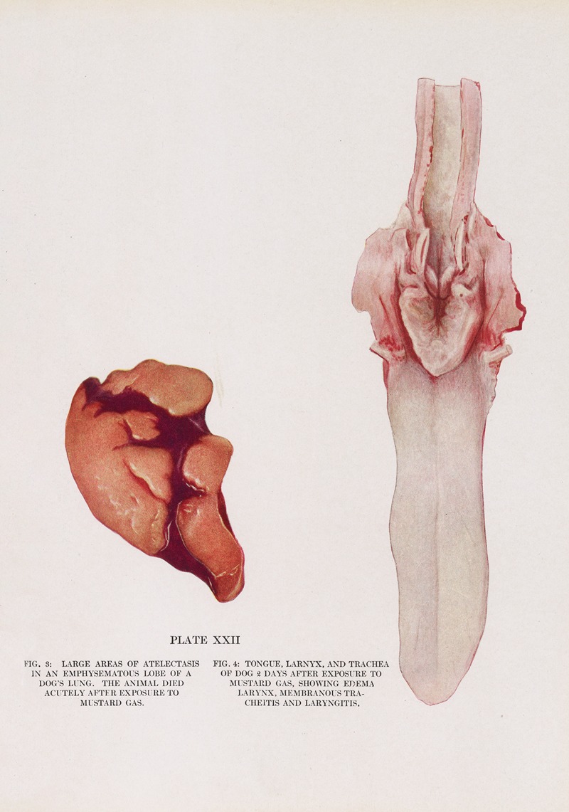 Milton C. Winternitz - Plate XXII (Fig. 3): Large areas of atelectasis in an emphysematous lobe of a dog’s lung. (Fig. 4) Tongue, larynx, and trachea of dog 2 days after exposure to mustard gas, showing edema of larynx, membranous tracheitis, and laryngitis.