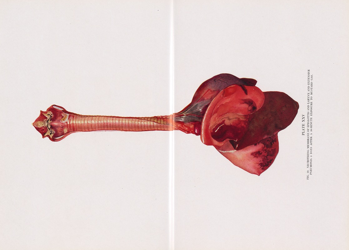 Milton C. Winternitz - Plate XXV (Fig. 19): Necrotizing membrane of epiglottis and larynx and extensive pneumonia 5 days after a 30-minute exposure to mustard gas.