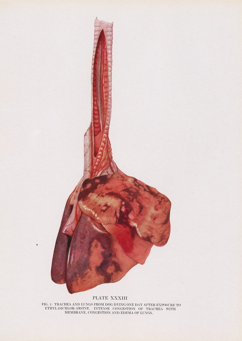 Milton C. Winternitz - Plate XXXIII (Fig. 1): Trachea and lungs from dog dying 1 day after exposure to ethyldichlorarsine.