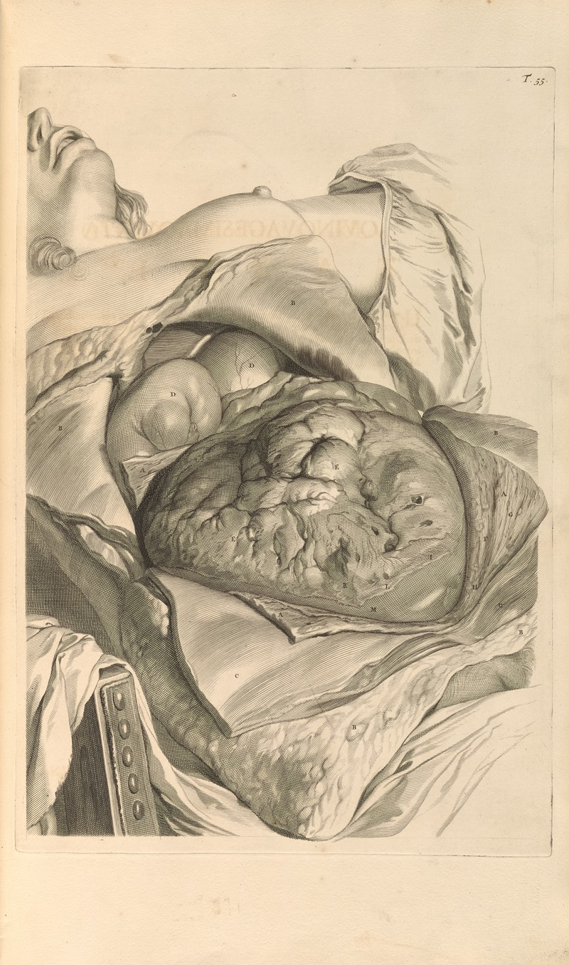 Gerard de Lairesse - Anatomia humani corporis Pl.056