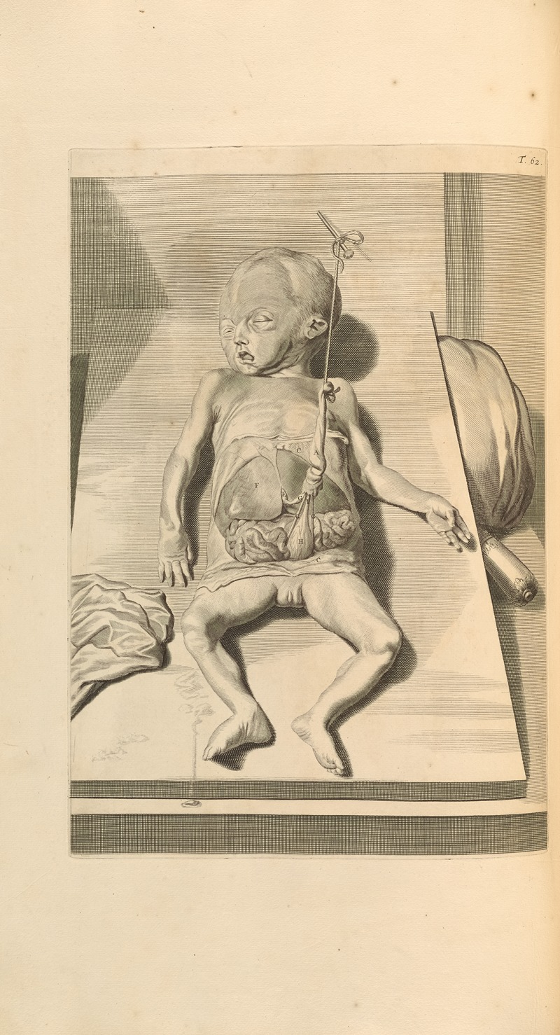 Gerard de Lairesse - Anatomia humani corporis Pl.063
