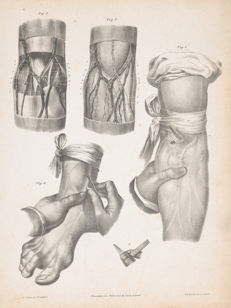 James Fuller Queen - Blood vessels in an arm and a foot, with two sections of an arm or leg showing the anatomy beneath the skin