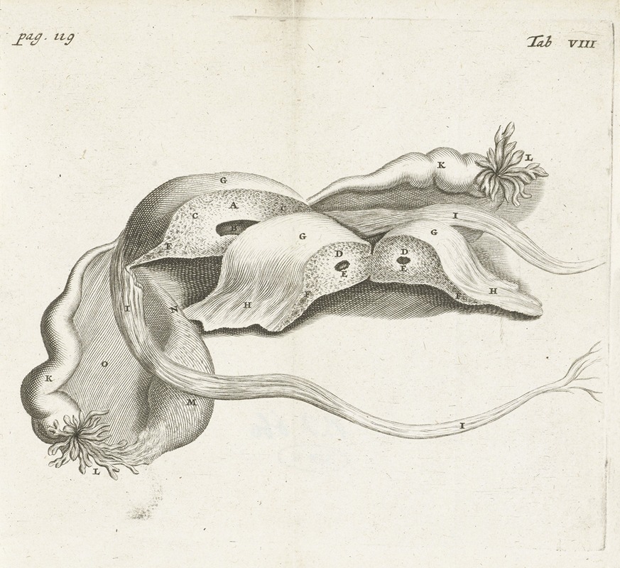 Hendrik Bary - Anatomical image of an ectopic pregnancy