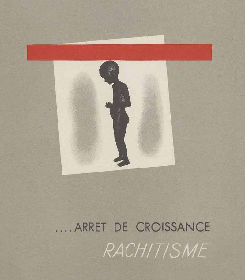 Anonymous - Arrêt de croissance ; rachitisme