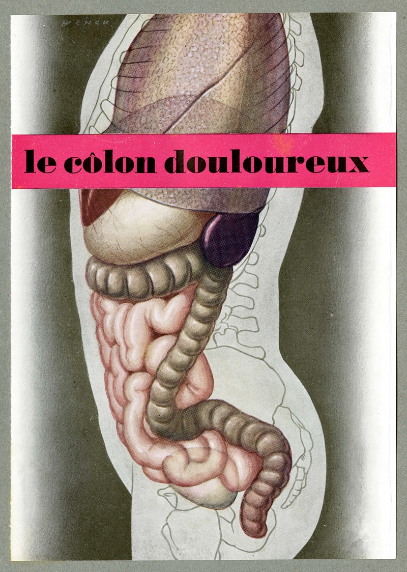 Wenck - Le côlon douloureux