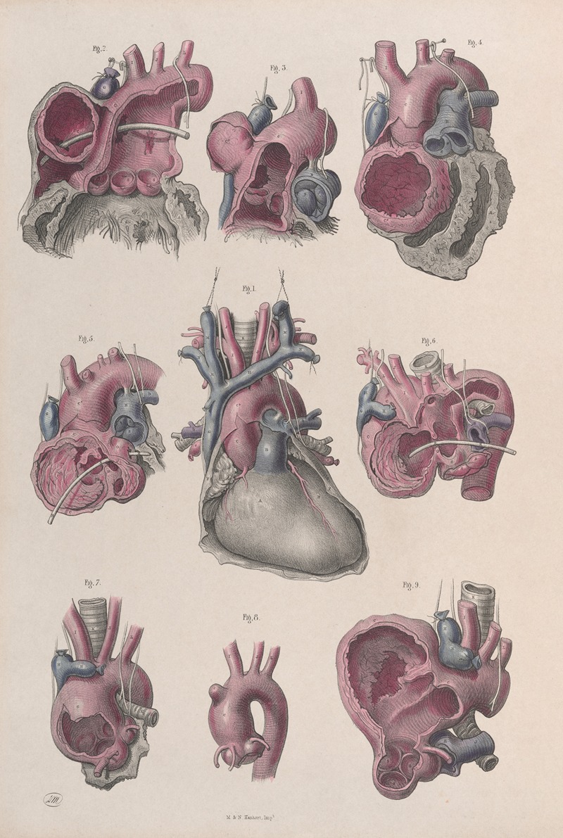 Joseph Maclise - Surgical anatomy Pl.14