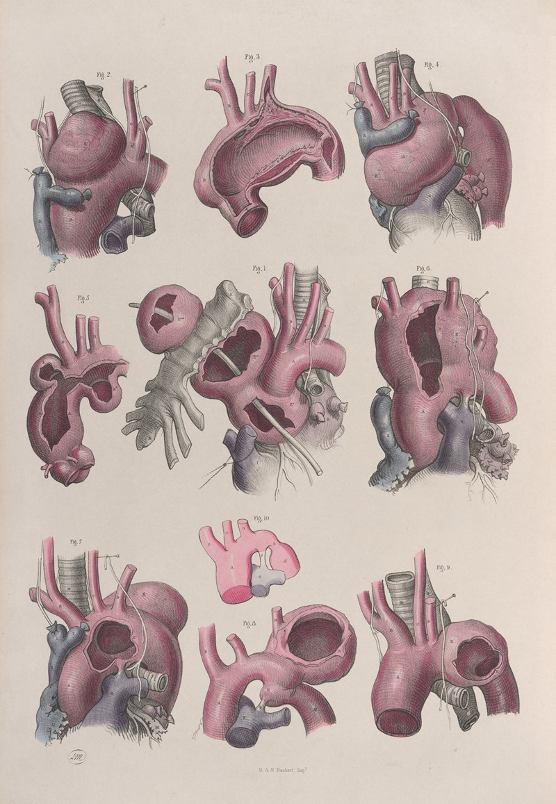 Joseph Maclise - Surgical anatomy Pl.15