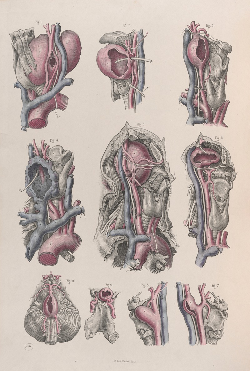 Joseph Maclise - Surgical anatomy Pl.17