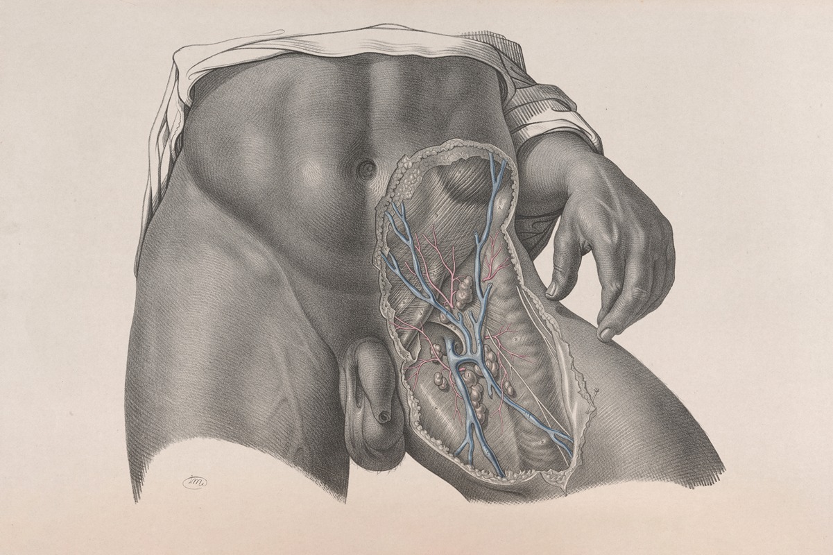 Joseph Maclise - Surgical anatomy Pl.26