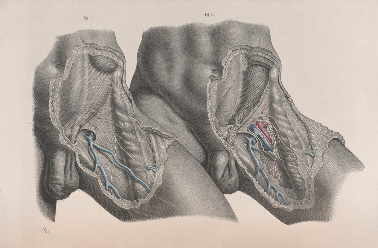 Joseph Maclise - Surgical anatomy Pl.27