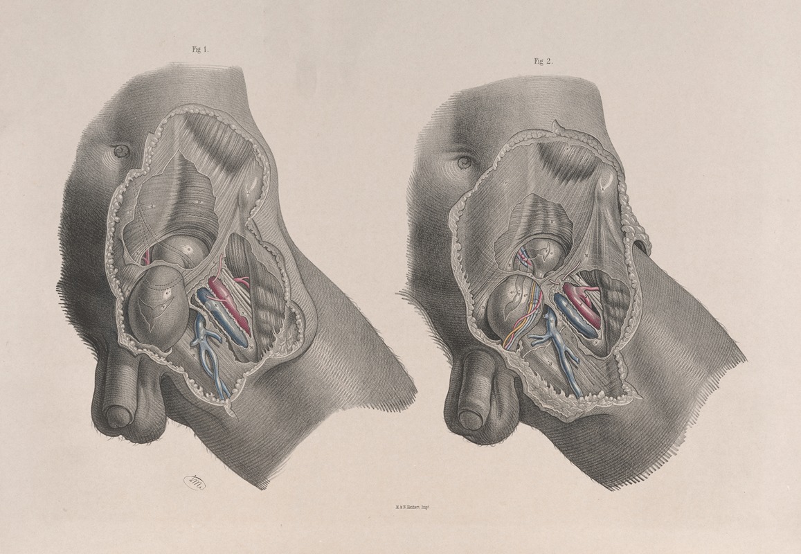 Joseph Maclise - Surgical anatomy Pl.30