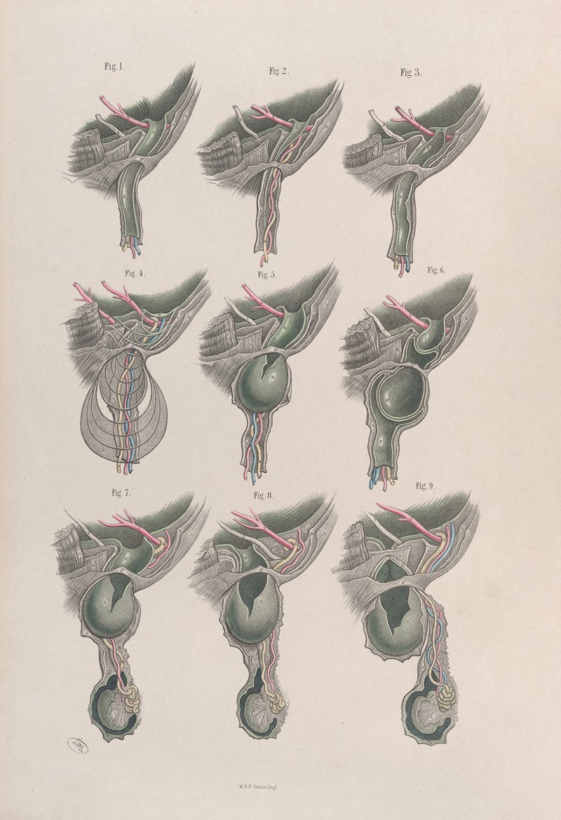 Joseph Maclise - Surgical anatomy Pl.33