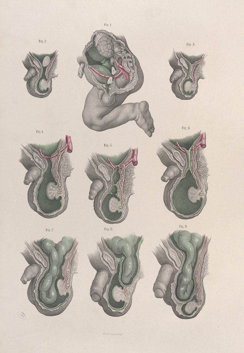 Joseph Maclise - Surgical anatomy Pl.34