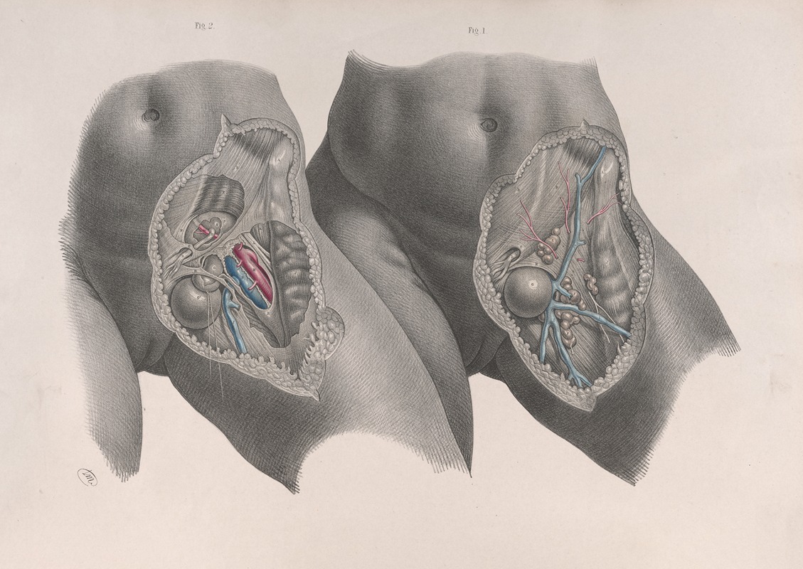 Joseph Maclise - Surgical anatomy Pl.35